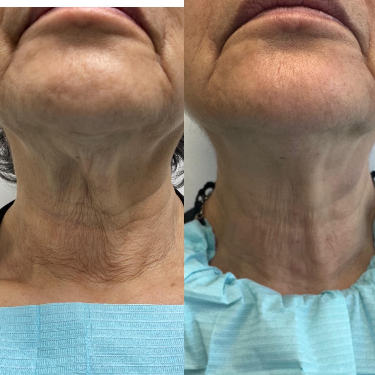 WhatsApp Image 2025-02-07 at 4.45.40 PM